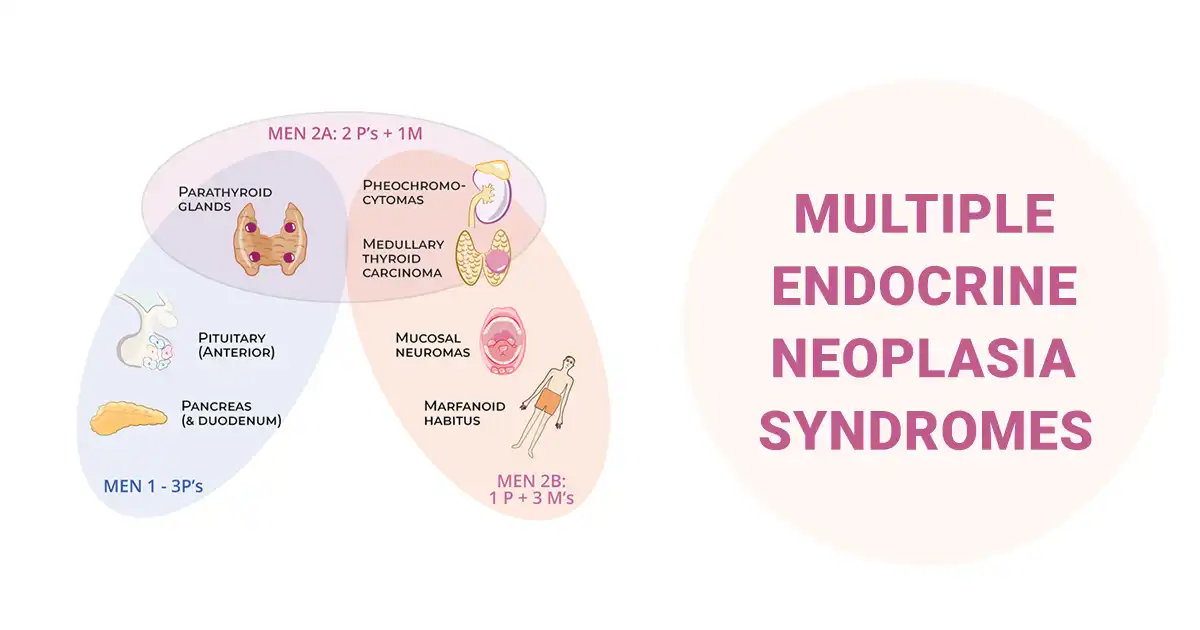 Multiple Endocrine Neoplasia Syndromes